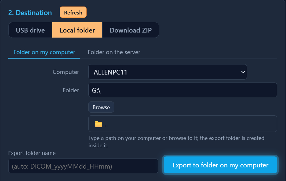 Destination card in Local folder mode with the folder browser